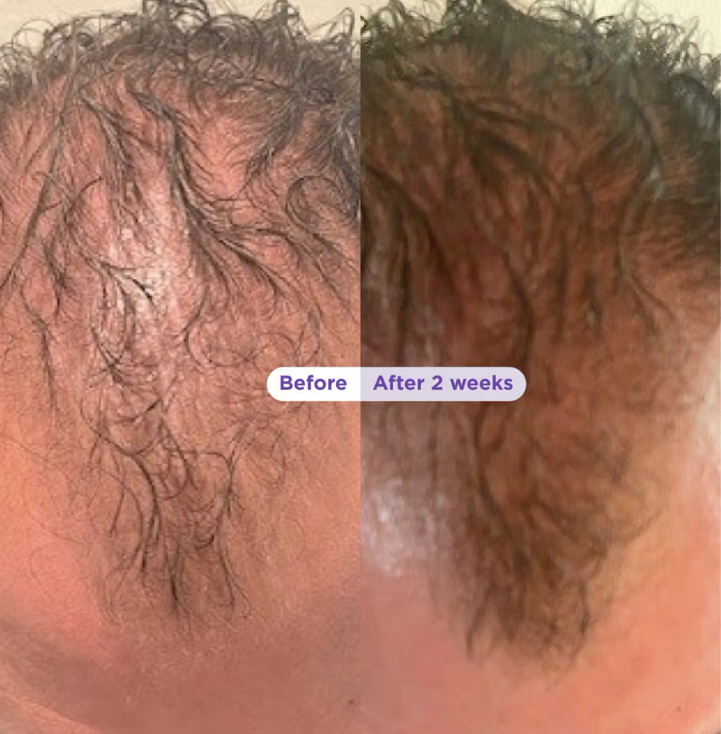 Coffret shampooing et après-shampooing épaississants à la biotine et au romarin, pour des cheveux plus denses et visiblement plus épais
