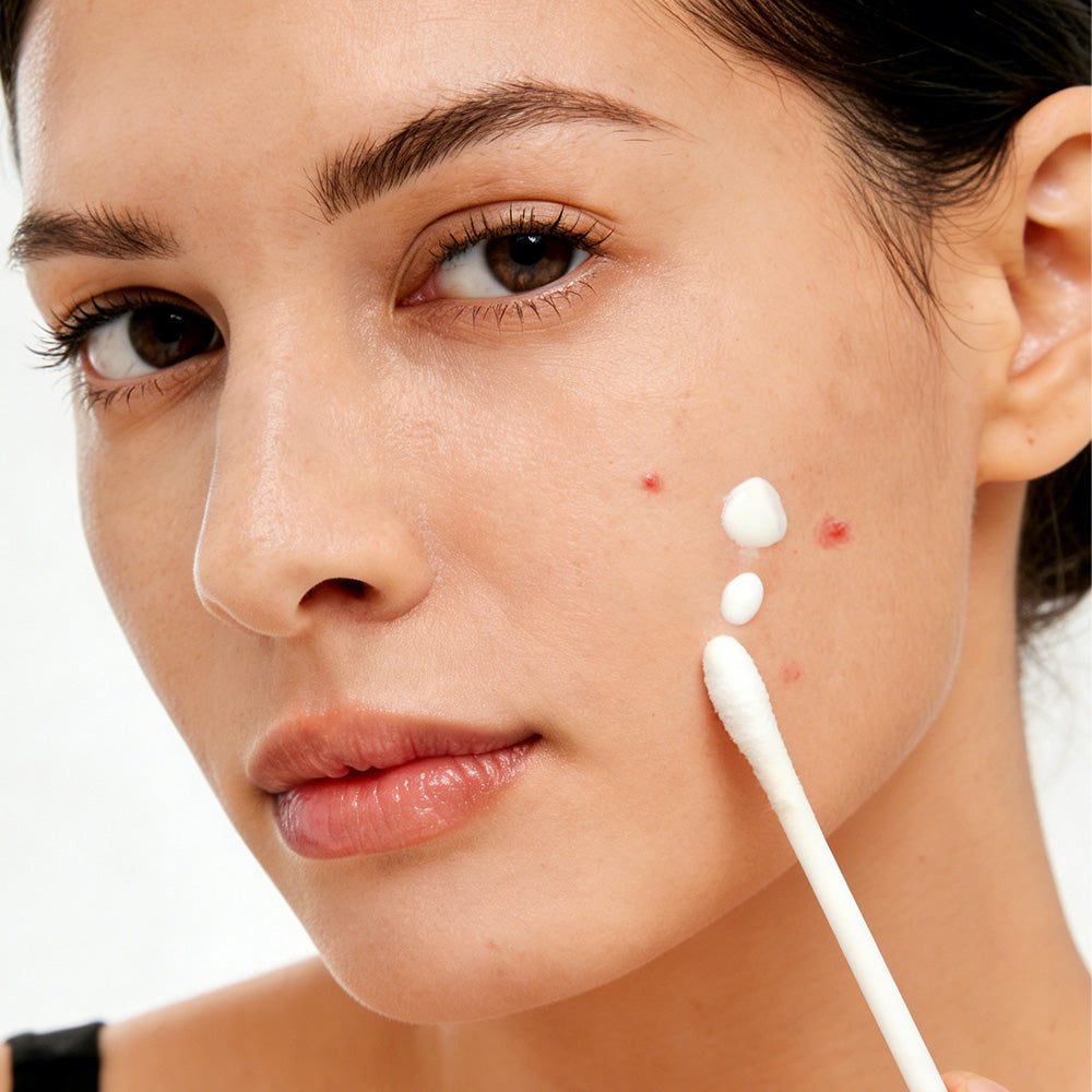 Salicylic Acid Drying Lotion for Acne, Breakouts & Oily Skin