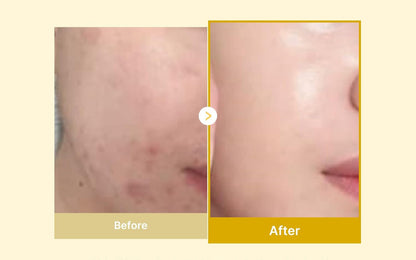 Kojic Acid & Turmeric Overnight Peel-Off Mask for Dark Spots & Brightening