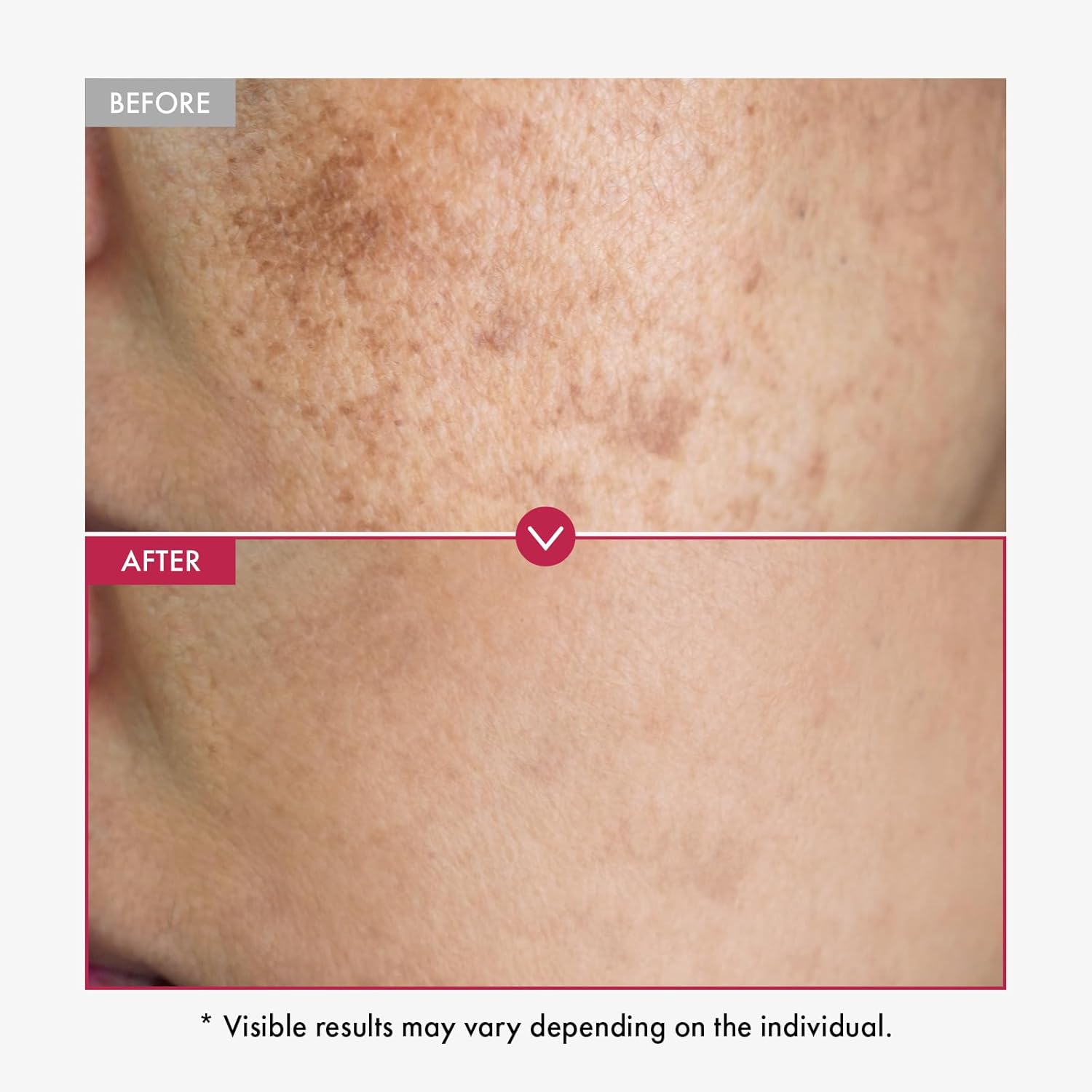 Sérum niacinamide 10 % + acide tranexamique 4 % pour peau de verre