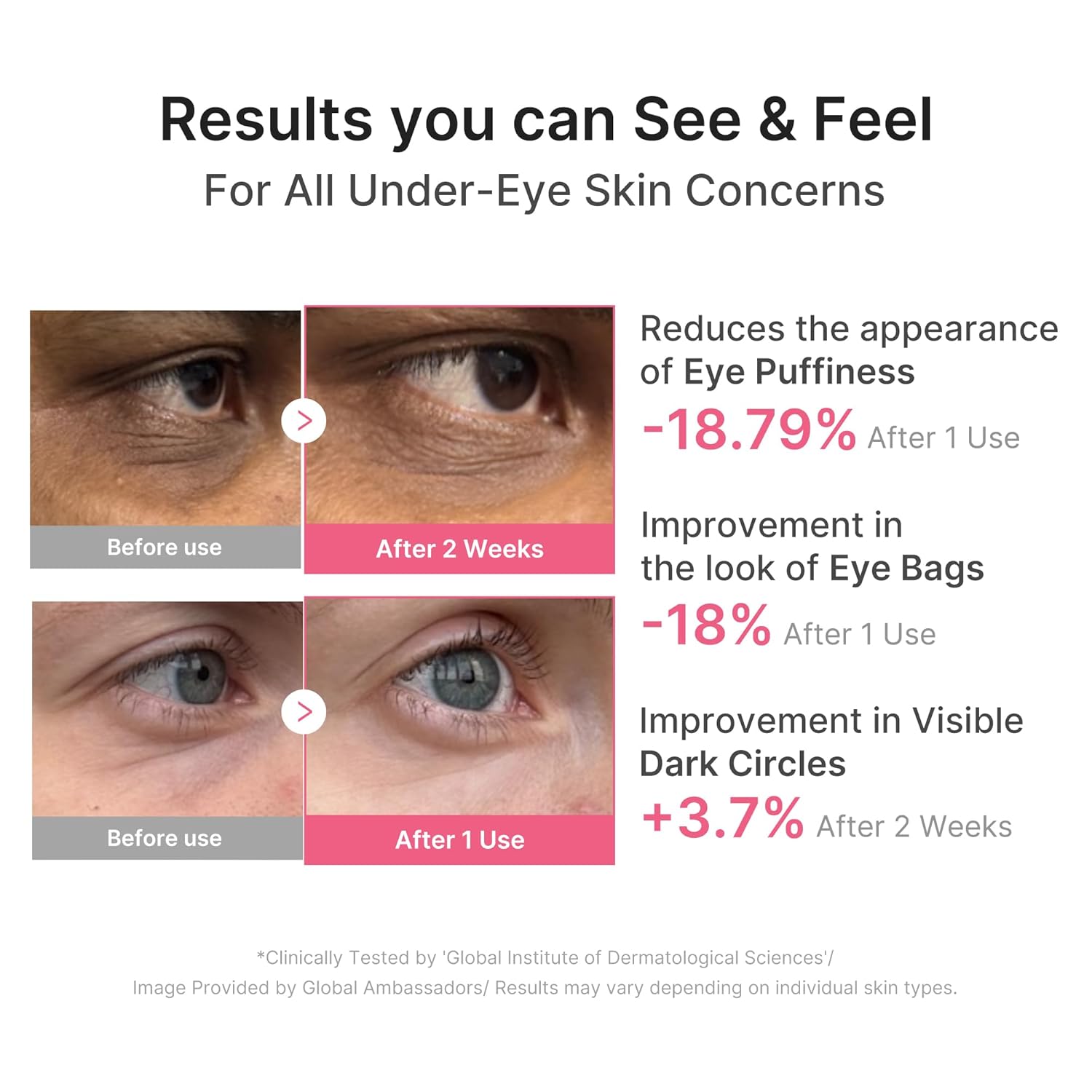 Parche para ojos con PDRN rosa y cafeína para hinchazón, ojeras e hidratación  