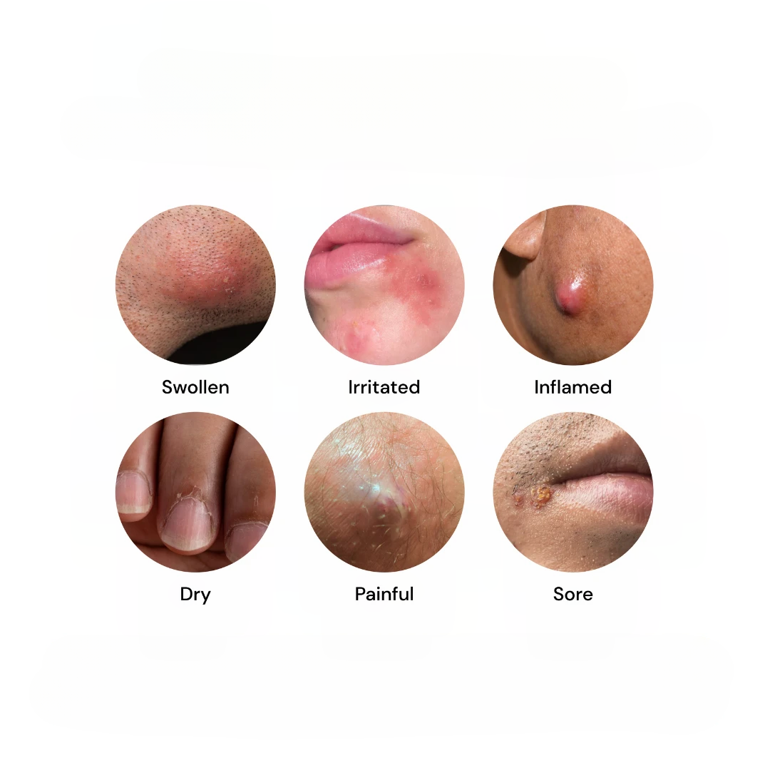 Universal Flare Care Sensitive Skin Cream featuring Propolis for Calm