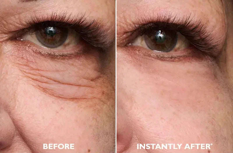 Instant FIRMx EyeTightening Serum for Puffiness, Wrinkles & Fine Lines