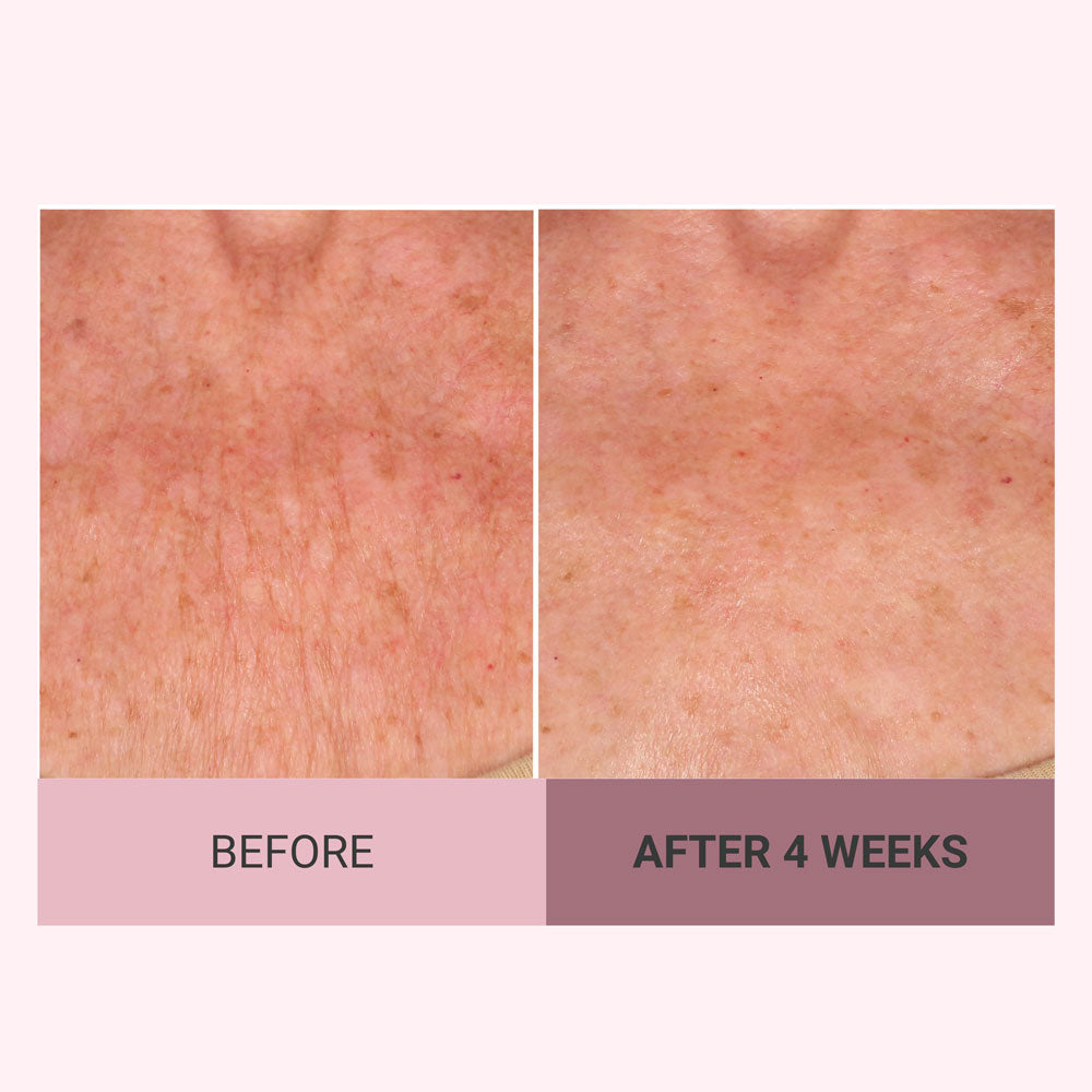 Champagne Firming Body Cream with Luxe-Lift Complex and Pink Pepperslim
