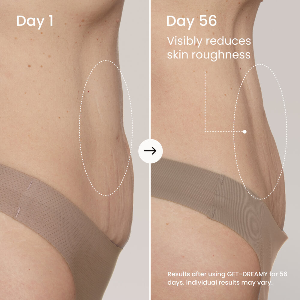 GET-DREAMY Overnight Toning Whip for Firming, Smoothing & Uneven Skin Texture