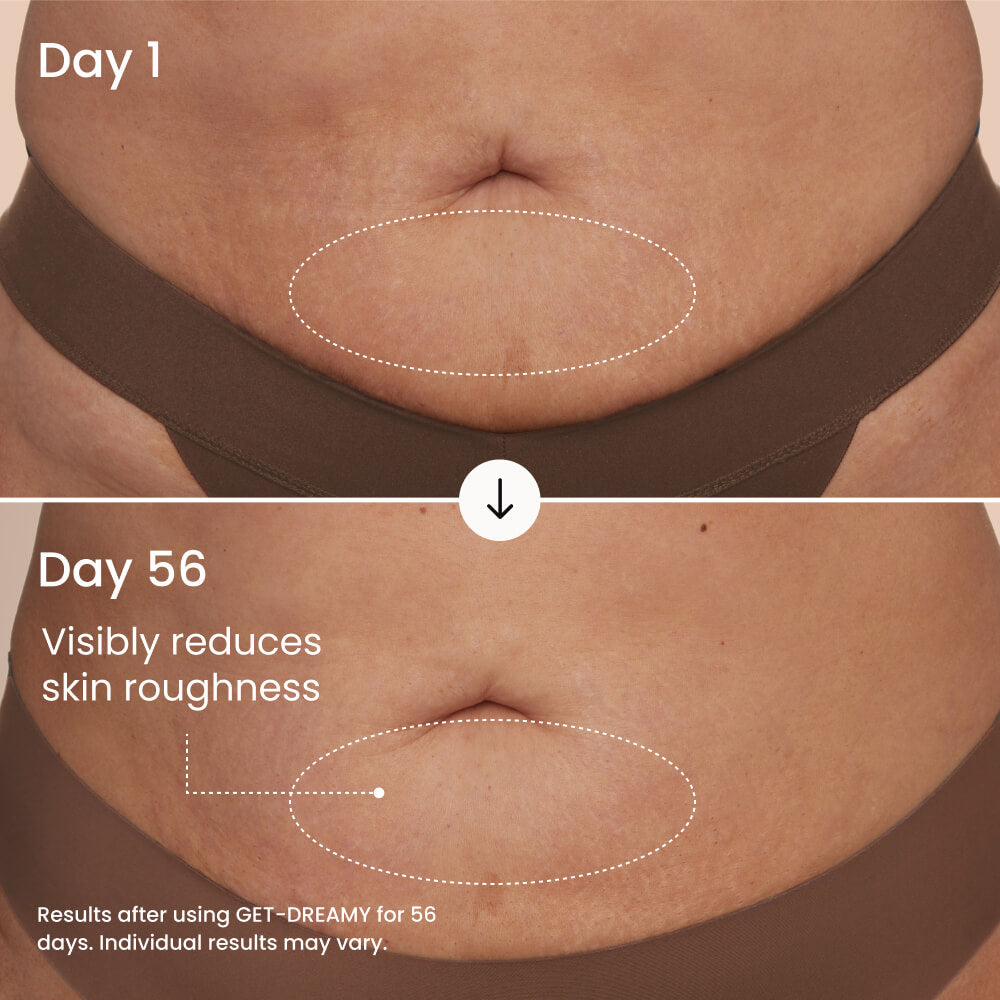 GET-DREAMY Overnight Toning Whip for Firming, Smoothing & Uneven Skin Texture