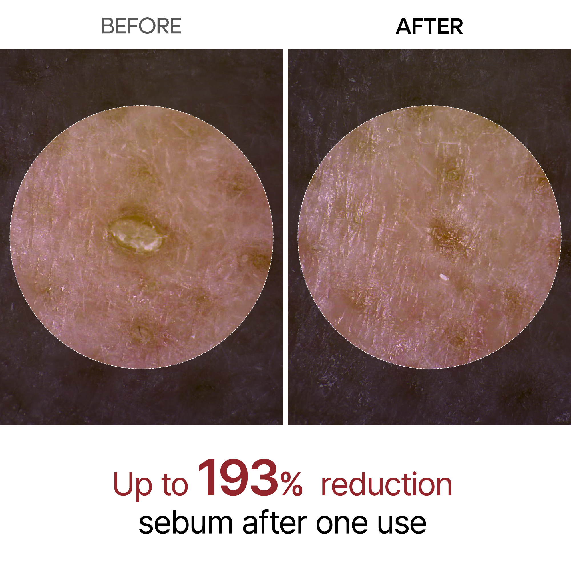 Set Peau Neuve Soin Coréen avec Niacinamide & Tonique au Riz pour peau terne  