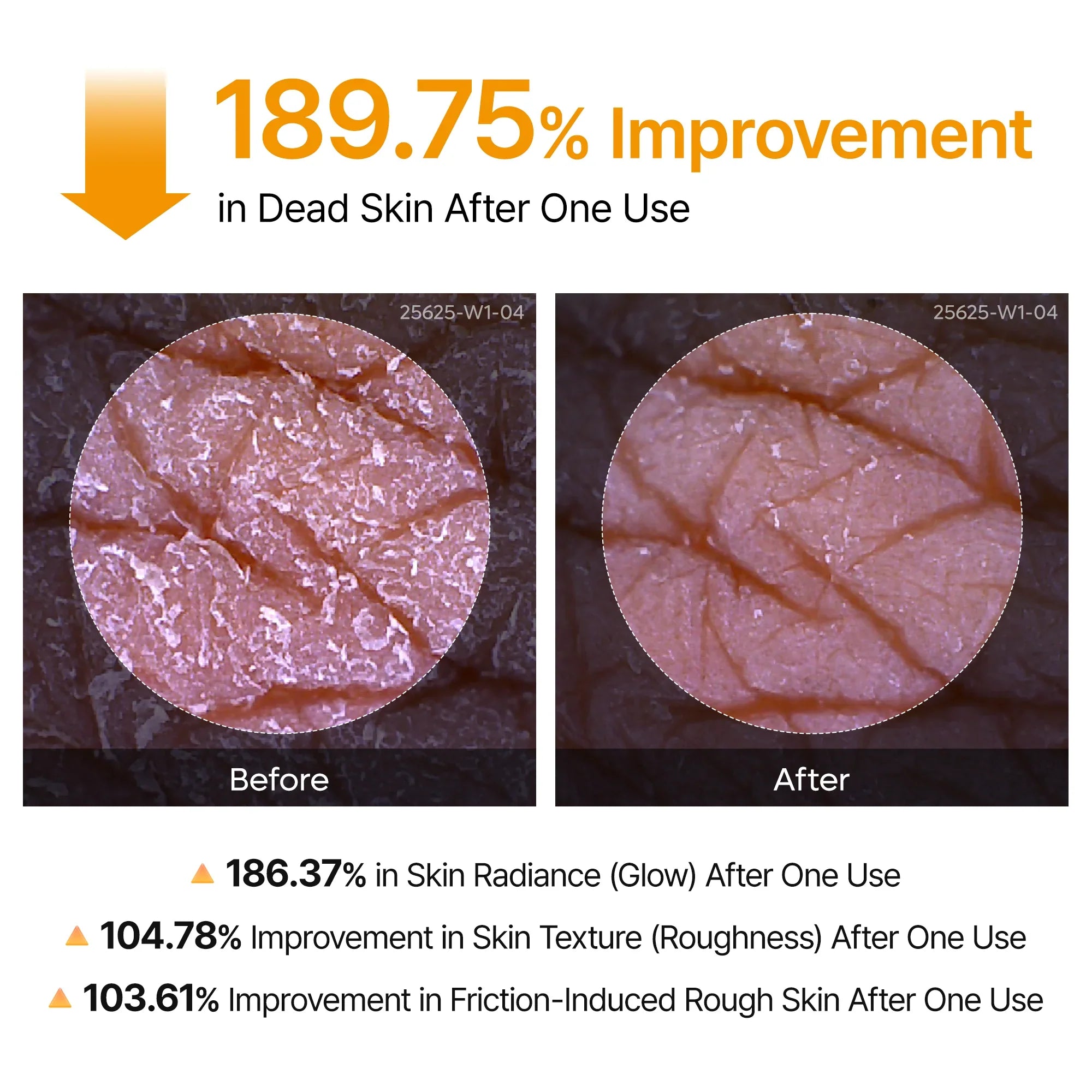 Dúo Peel Shot con Ácido Kójico y Cúrcuma para Manchas Oscuras, Hiperpigmentación e Iluminación  