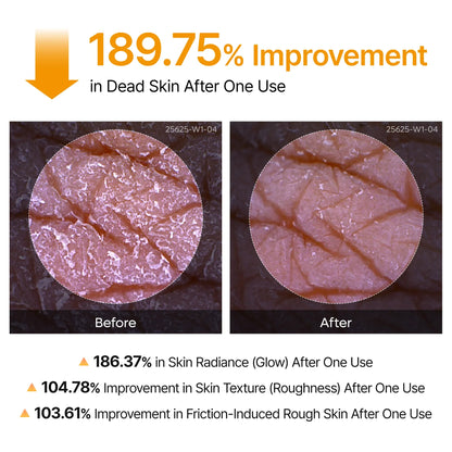 Peel Shot Kojic Acid Turmeric Duo for Dark Spots, Hyperpigmentation & Brightening