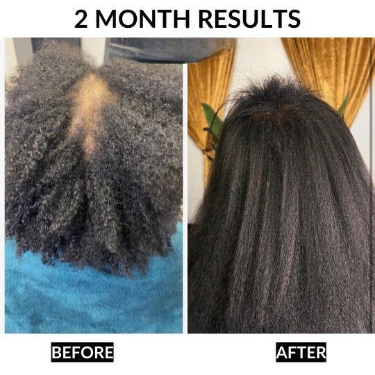 Healthy Hair Starter Kit for Stronger Hair, Growth & Scalp Care