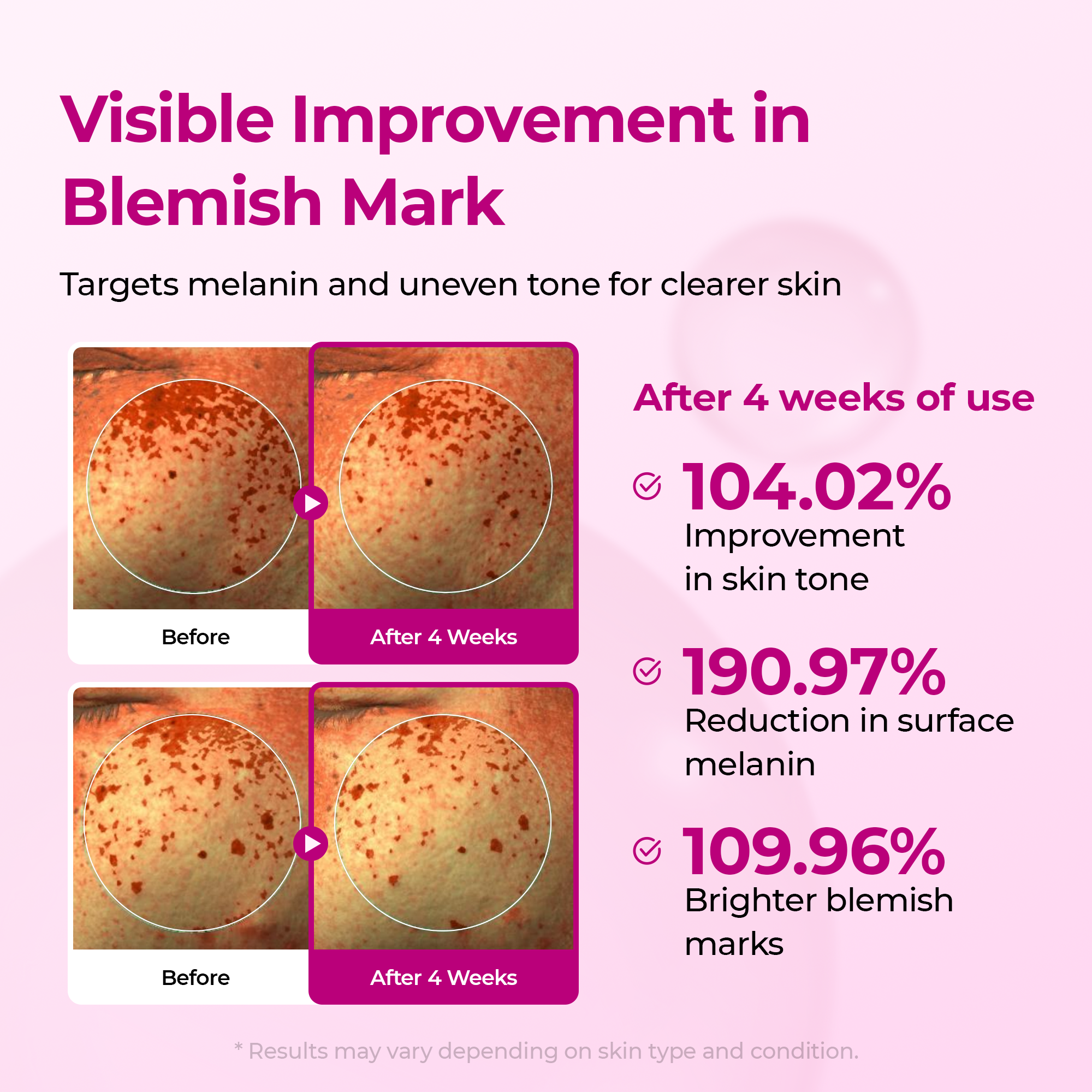 Duo de sérums Lumi pour les pores et les taches, pour les pores, les taches brunes et la pigmentation
