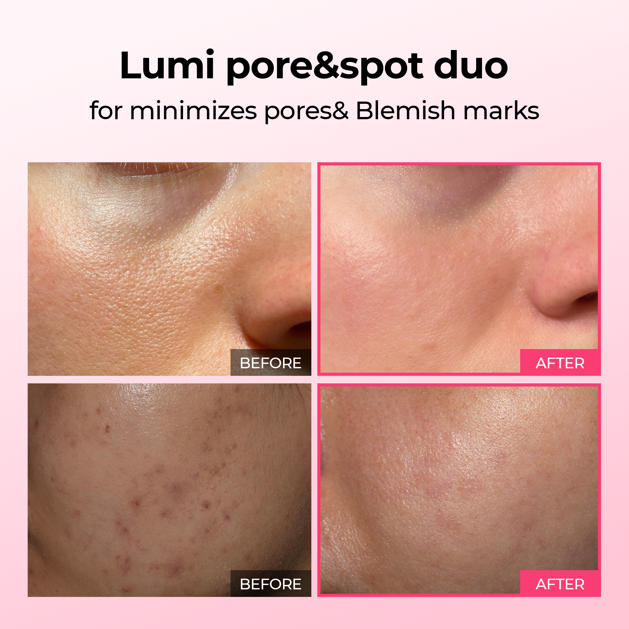 Duo de sérums Lumi pour les pores et les taches, pour les pores, les taches brunes et la pigmentation