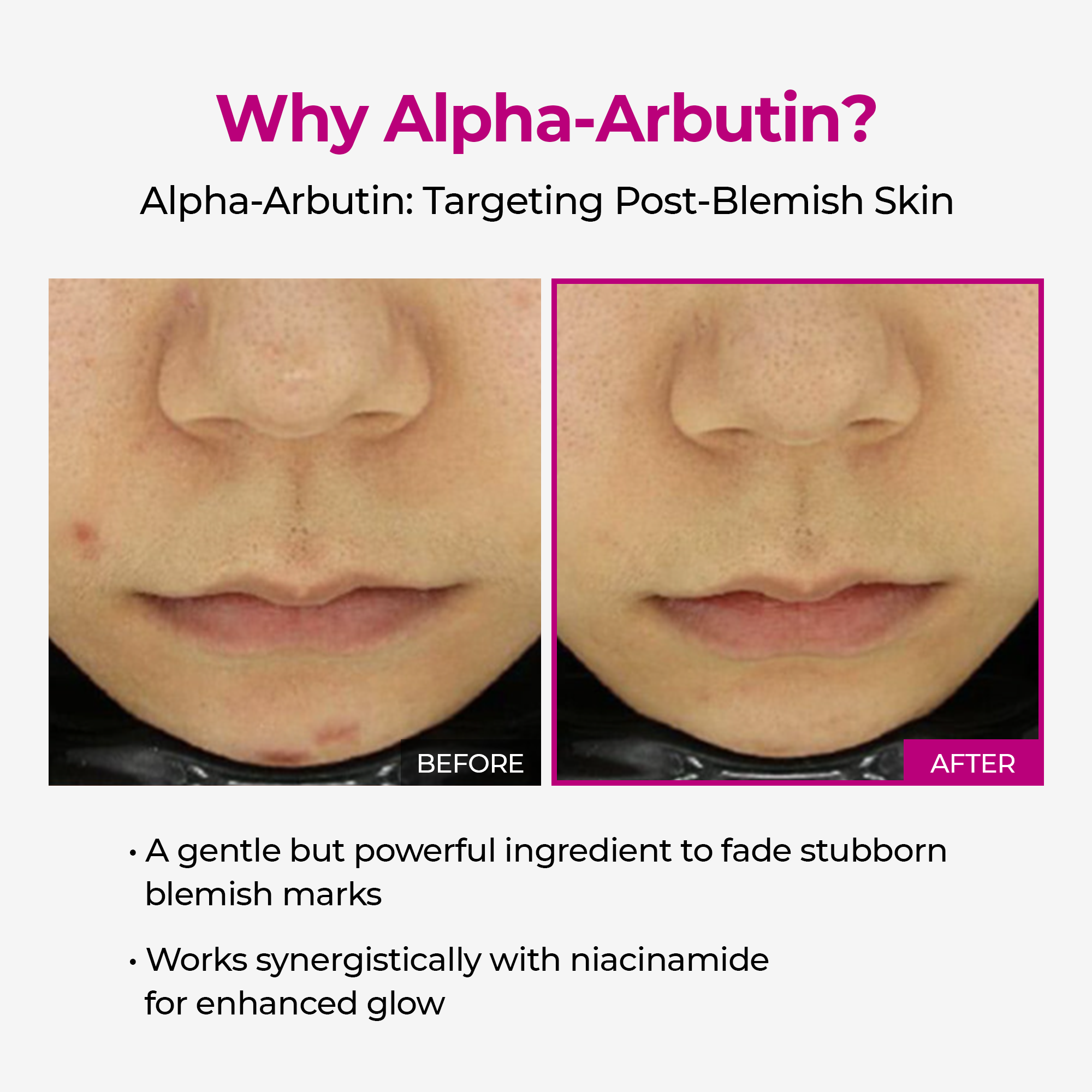 Duo de sérums Lumi pour les pores et les taches, pour les pores, les taches brunes et la pigmentation