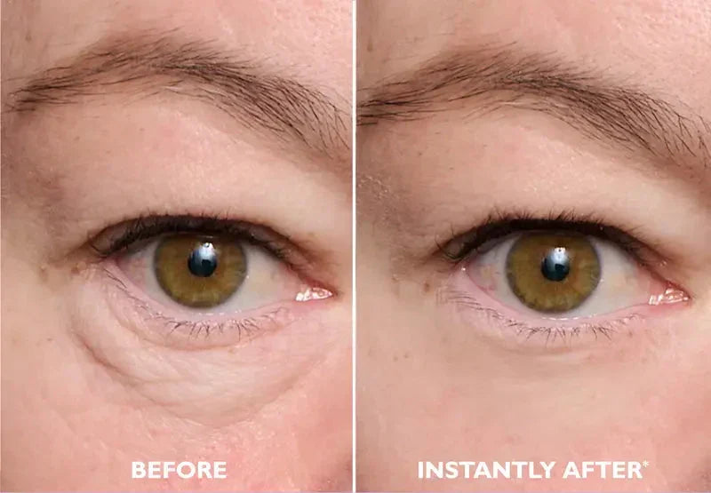 Instant FIRMx EyeTightening Serum for Puffiness, Wrinkles & Fine Lines