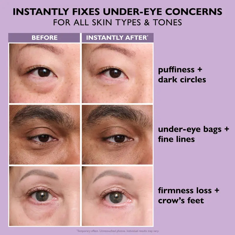 Instant FIRMx EyeTightening Serum for Puffiness, Wrinkles & Fine Lines