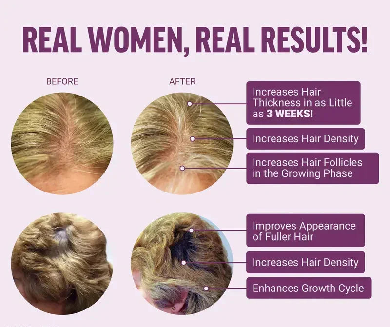 Hair Growth Accelerator Biotin Supplement with Zinc for Thicker & Fuller Hair